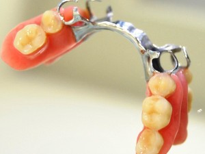 Empezando a utilizar una prótesis dental