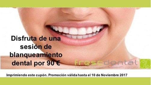 Blanqueamiento Dental a un precio muy especial